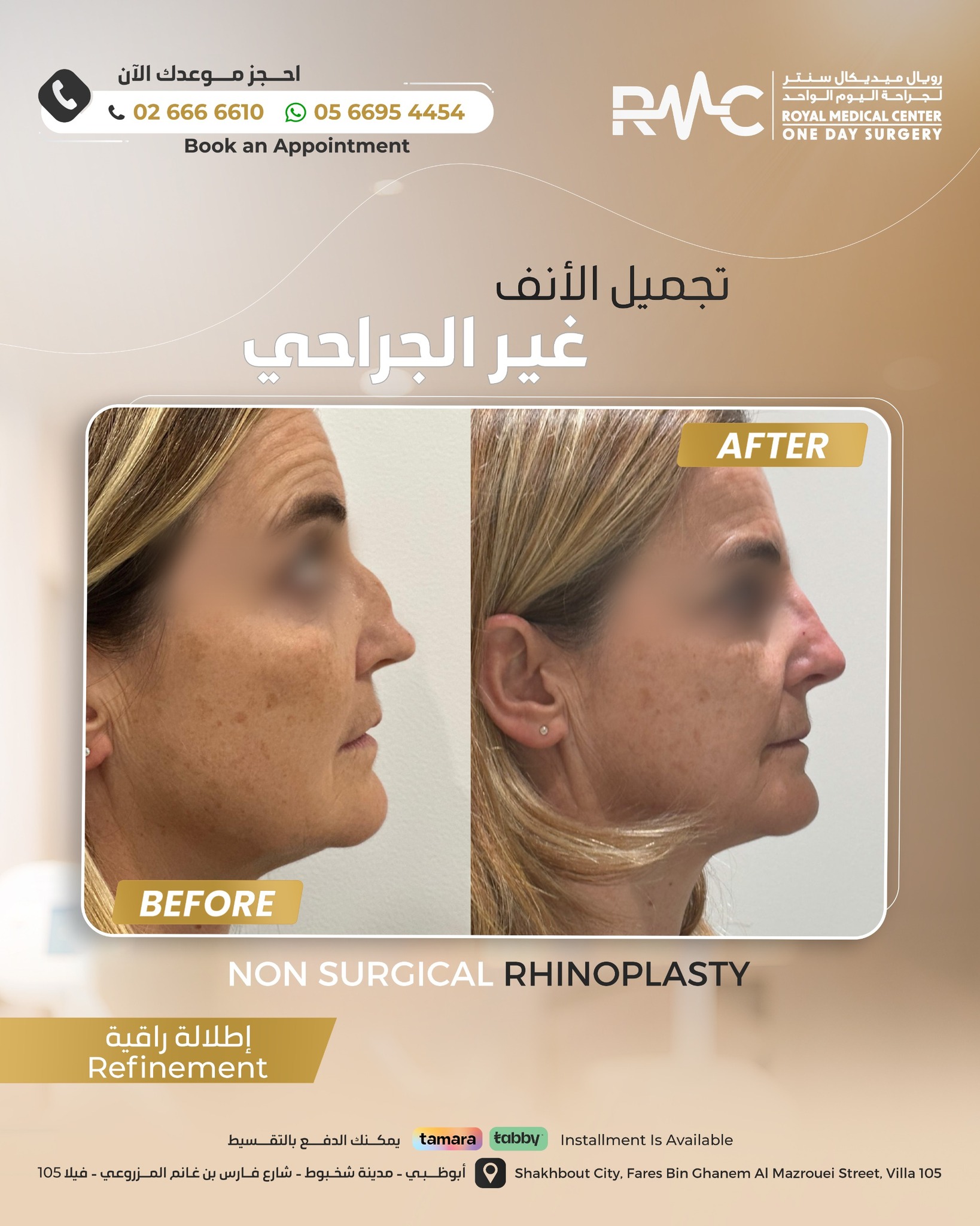 Royal Medical Center - One Day Surgery Facebook ad