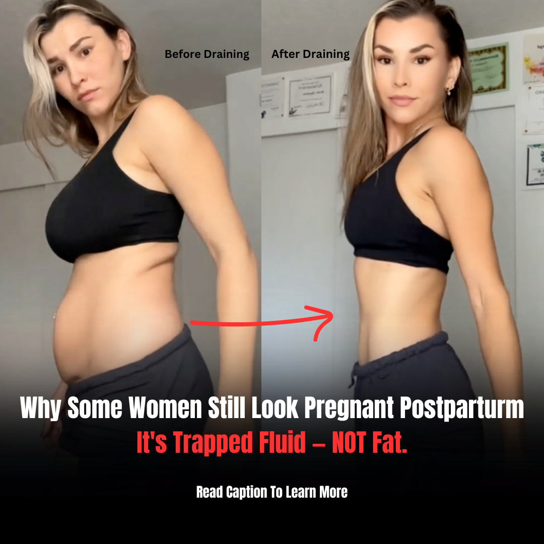 Naturesunrise Facebook ad: It's Not Fat. Here's How To Drain It