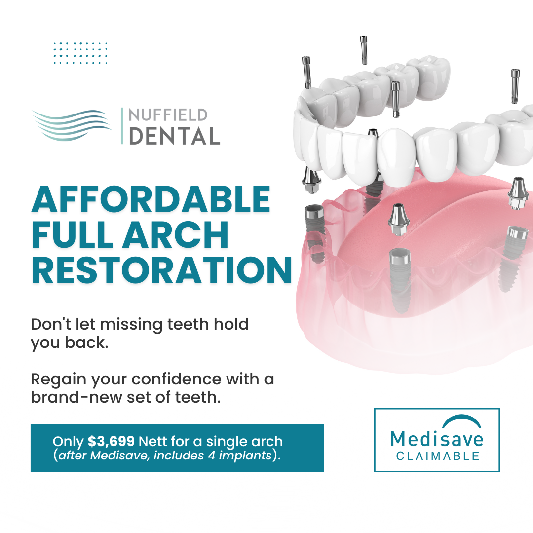 Nuffield Dental Facebook ad