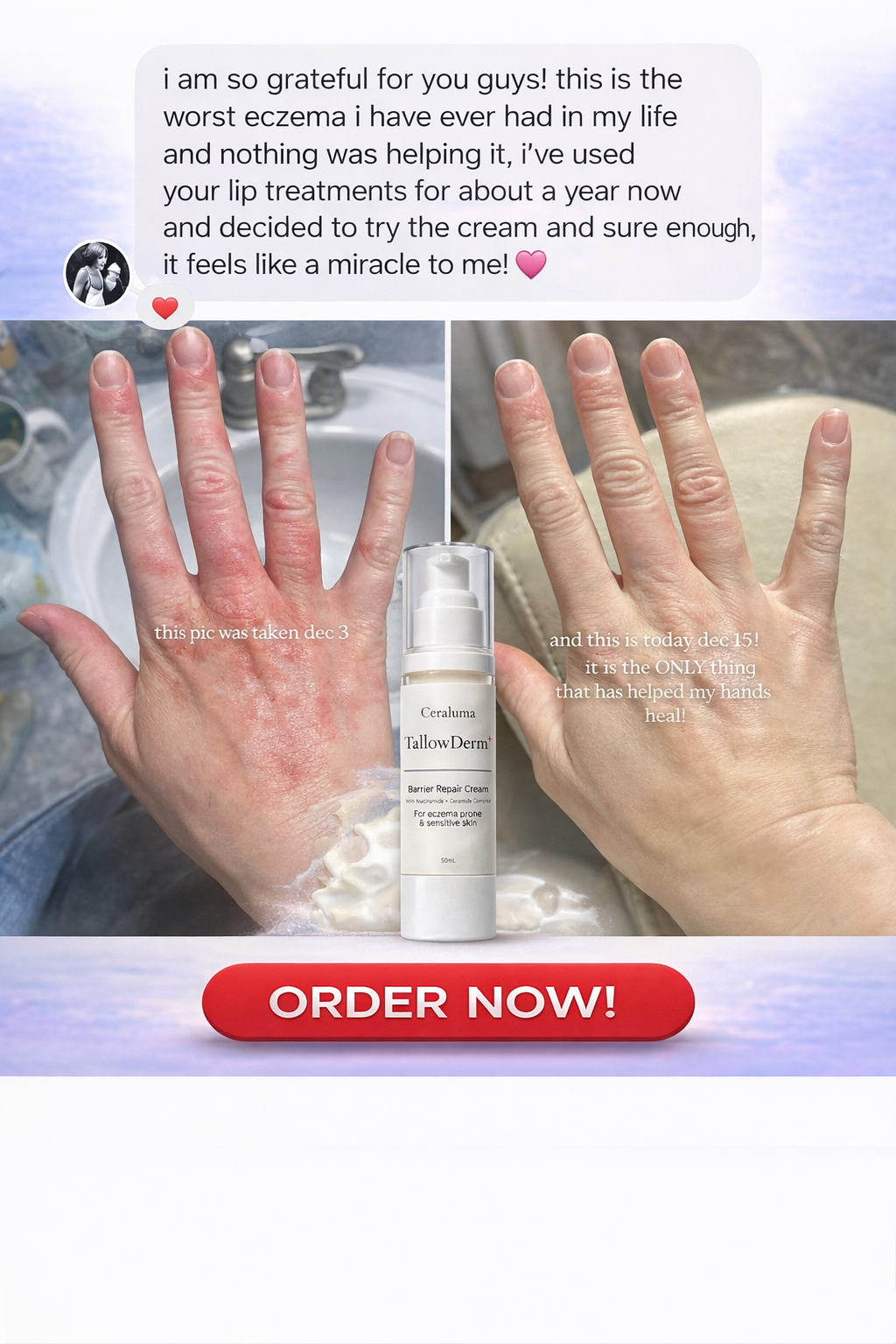 Ceraluma TallowDerm+ Facebook ad