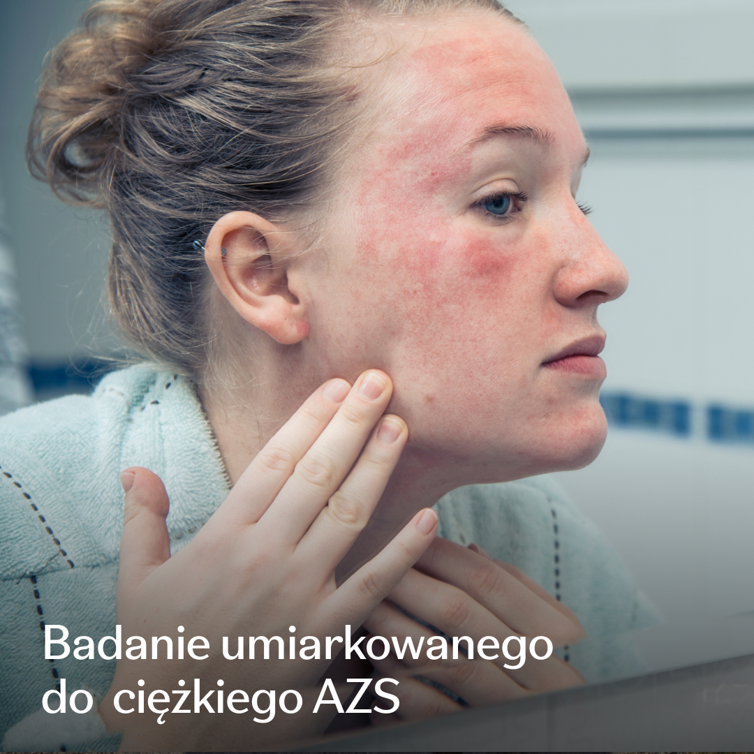 Eczema Research Study Facebook ad: Umiarkowane do ciężkiego AZS