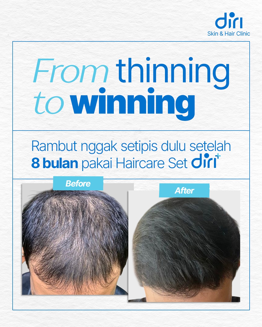 Diri Care Facebook ad