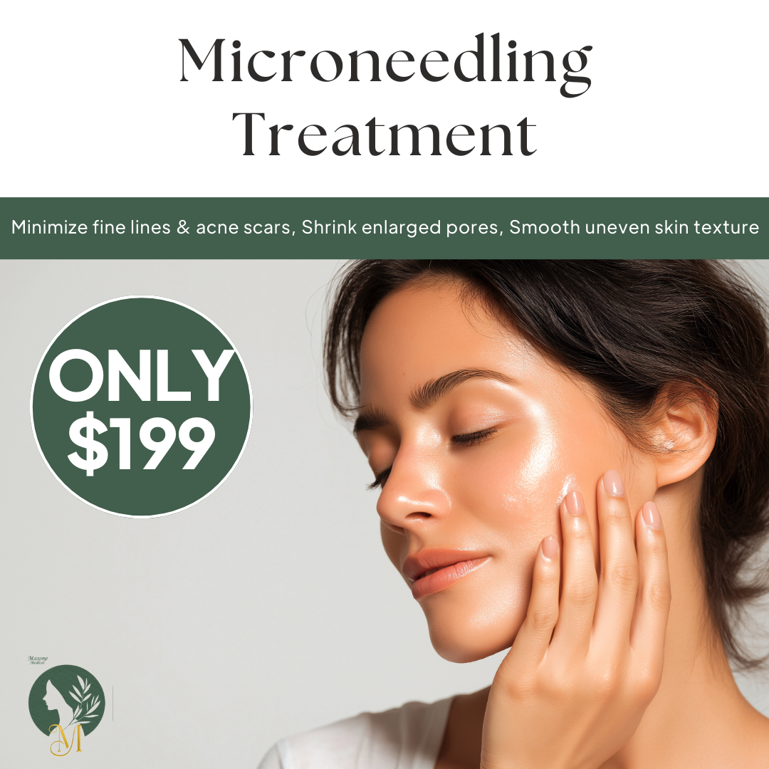 Masone Medical Aesthetics Facebook ad: $199 Microneedling Treatment (Reg. $250)