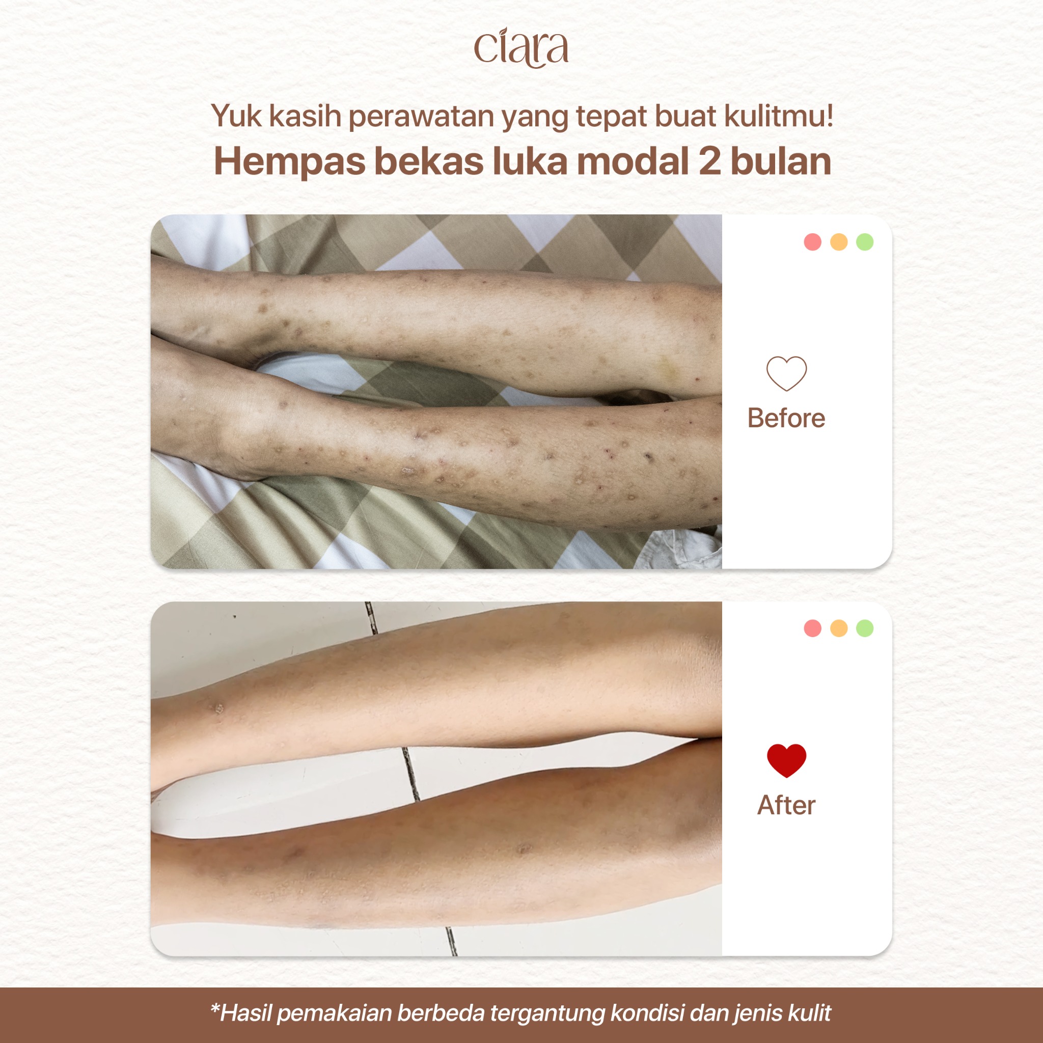Ciara Indonesia Facebook ad