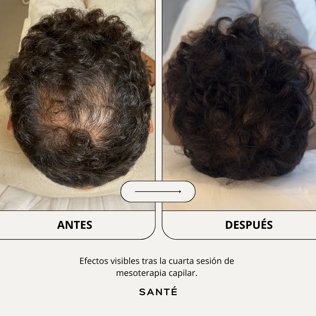 SANTÉ Clínica Estética Facebook ad