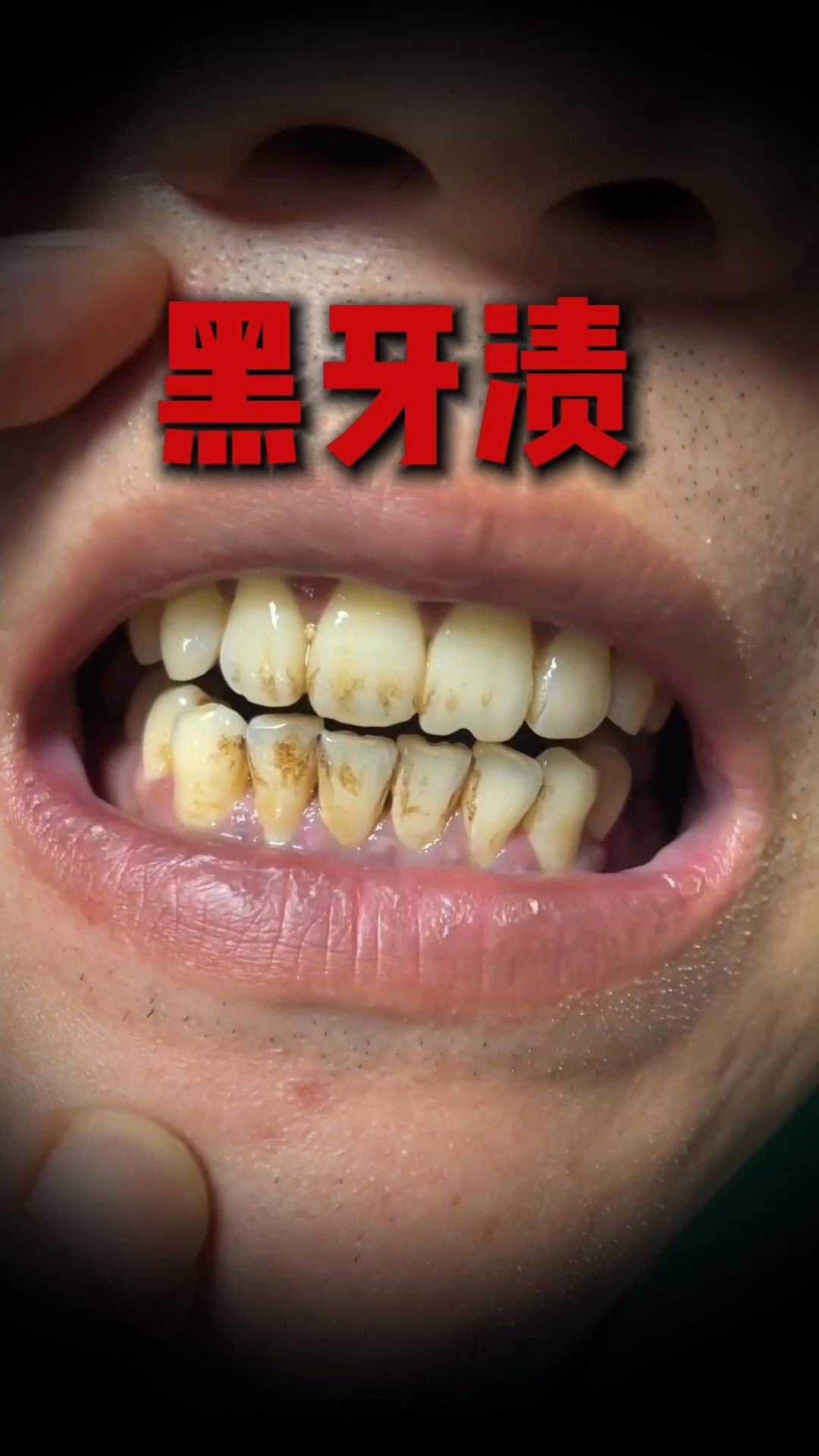 Dr Smile Whitening Facebook ad: 50家Pharmacy售卖 5年销量第一 卖出超过200千罐的牙粉