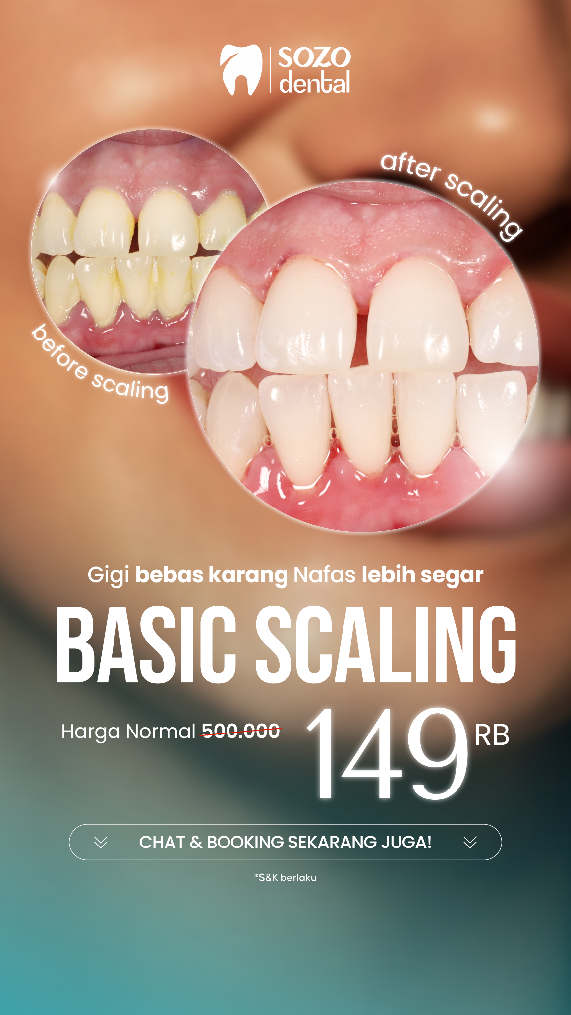 Sozo Dental Clinic Facebook ad