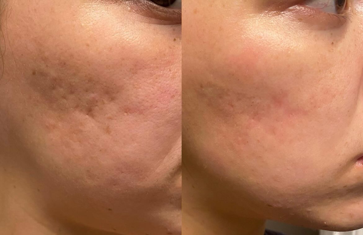 lauren_celsiusmedspa Facebook ad