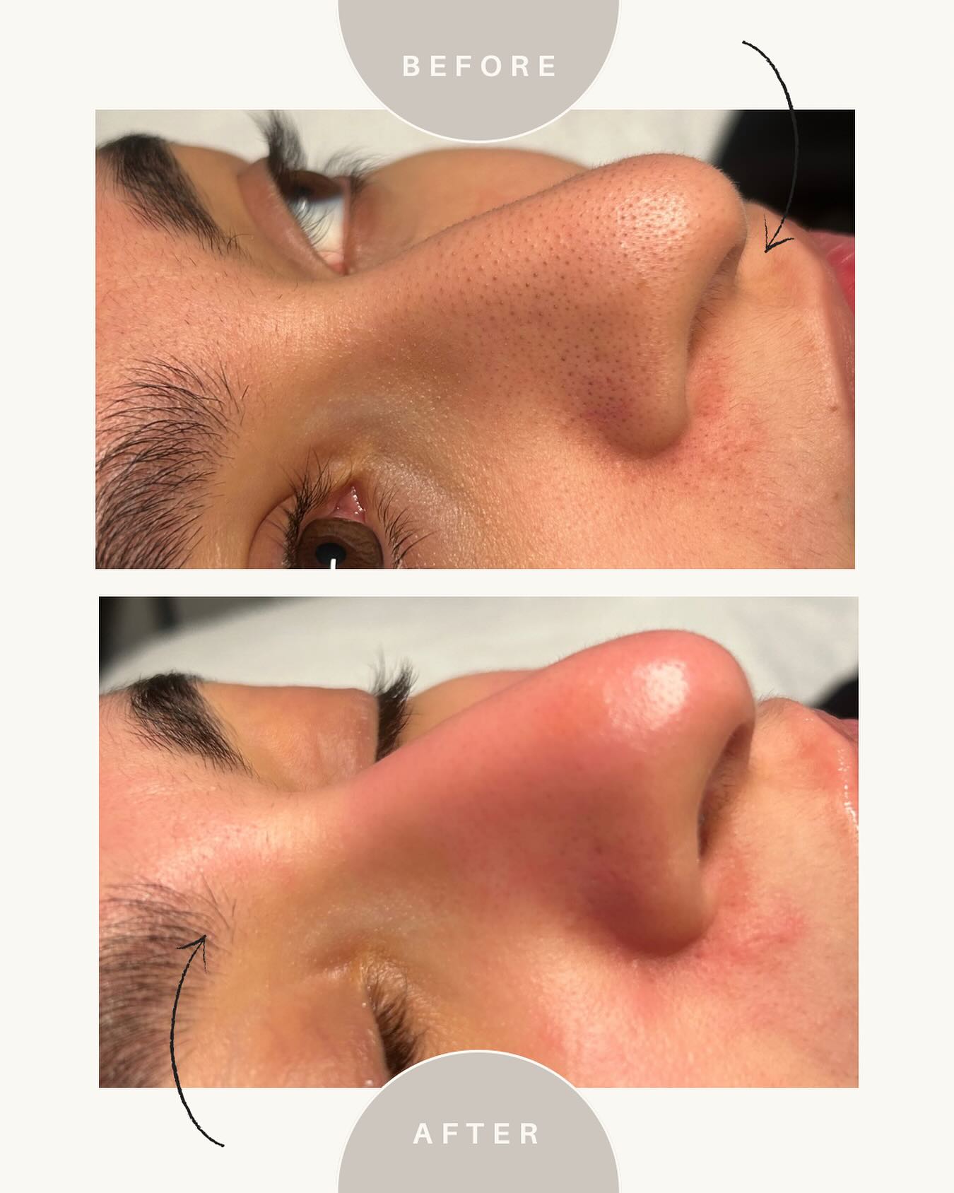 im.skinlab Facebook ad: Incroyable transformation avec notre soin Hydraskin