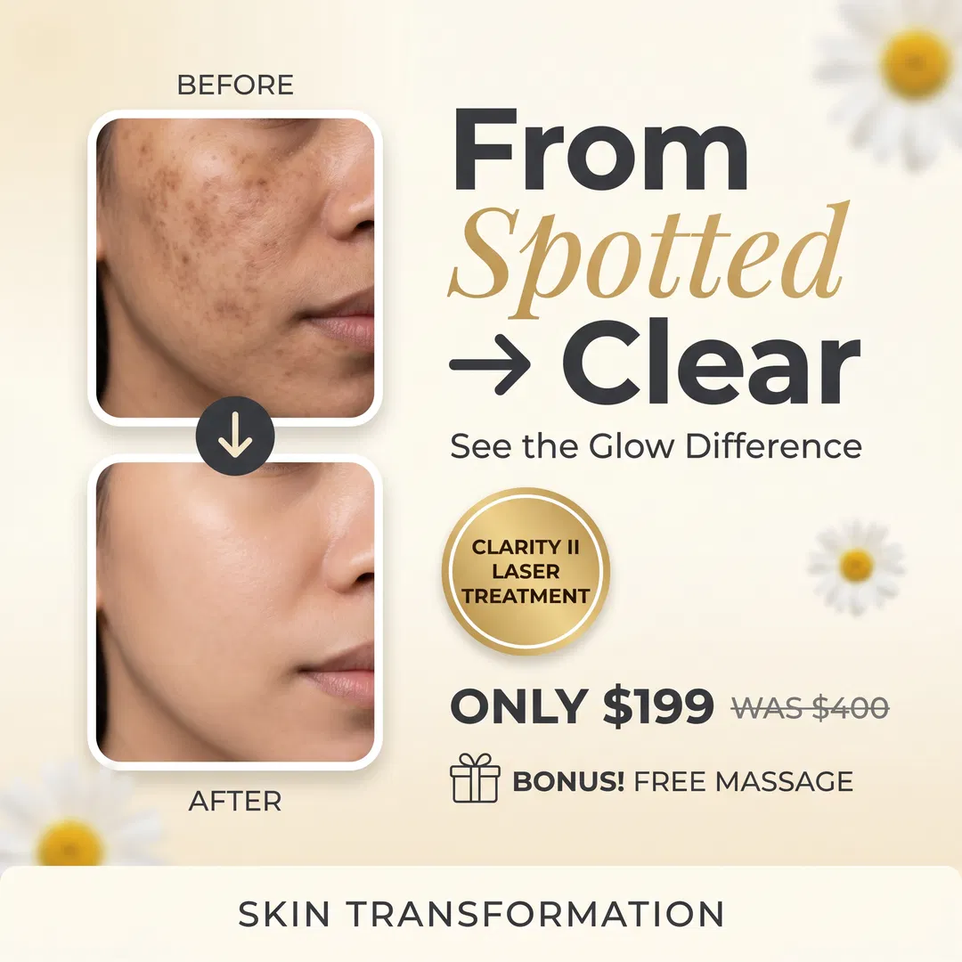 Renew Med Spa Facebook ad: 50% OFF This Month!