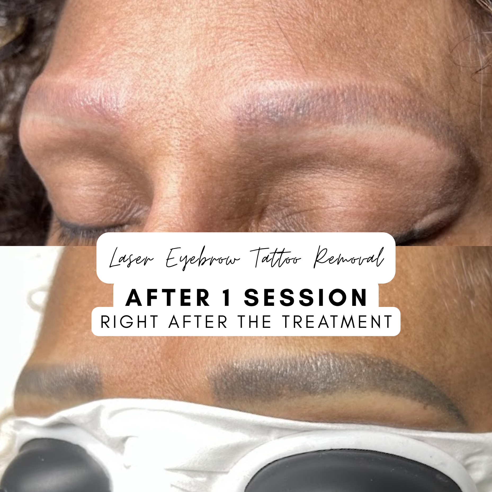 Roc Aesthetics Facebook ad