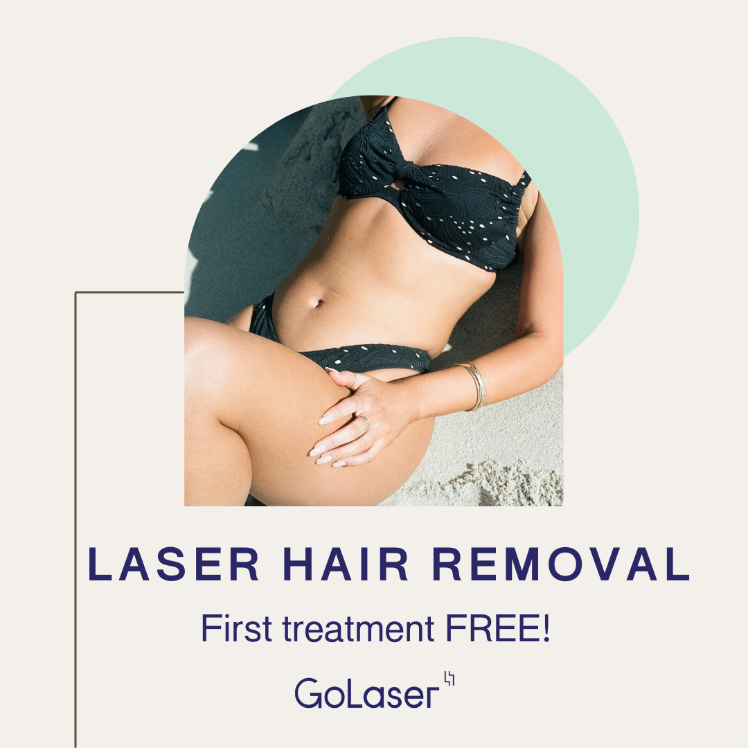 GoLaser Facebook ad