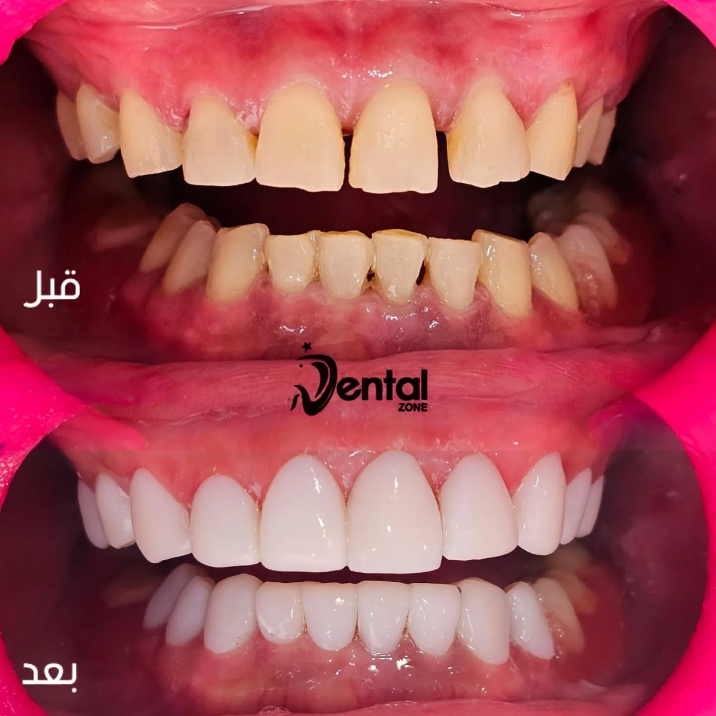 Dental Zone Facebook ad