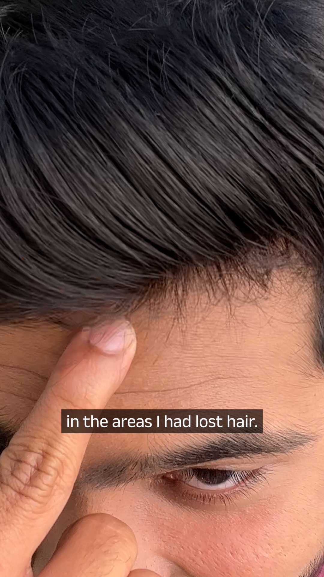Vedix Singapore Facebook ad: Your Secret to 3X Stronger & Healthier Hair Tailored Just…