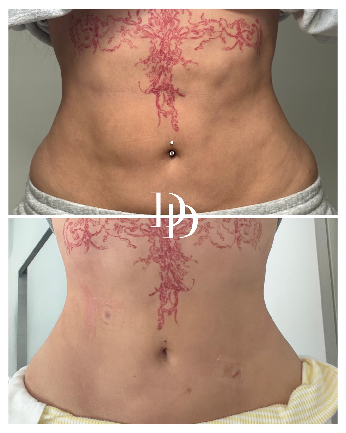 Dr Ducu Clinics Facebook ad: SkinTight | Skin Firming & Fibrosis Correction