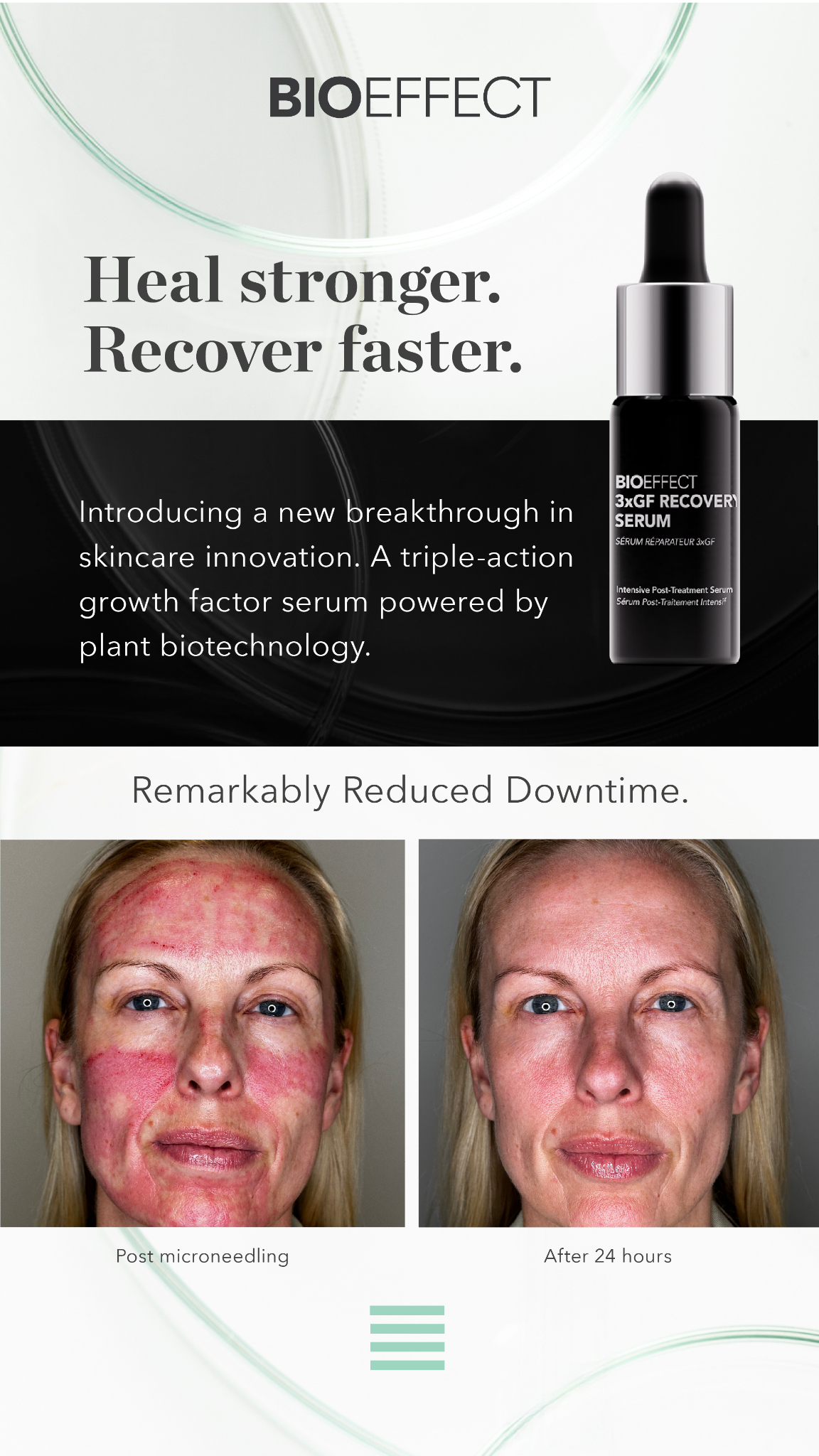 BIOEFFECT Facebook ad