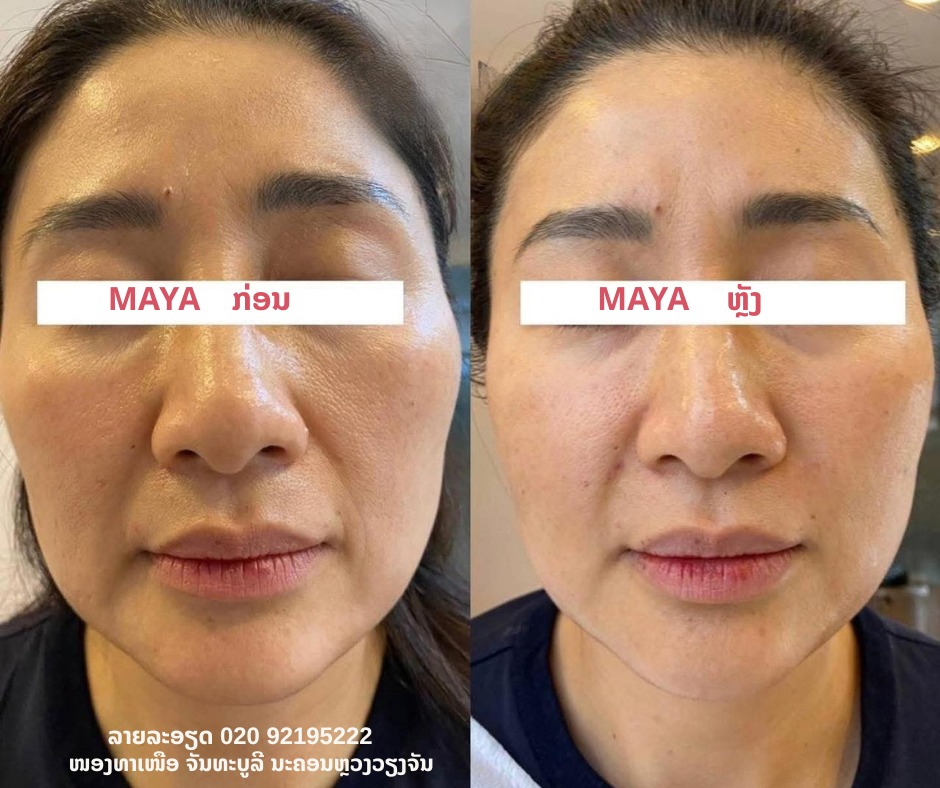 MAYA Spa-Vientiane LAO Facebook ad