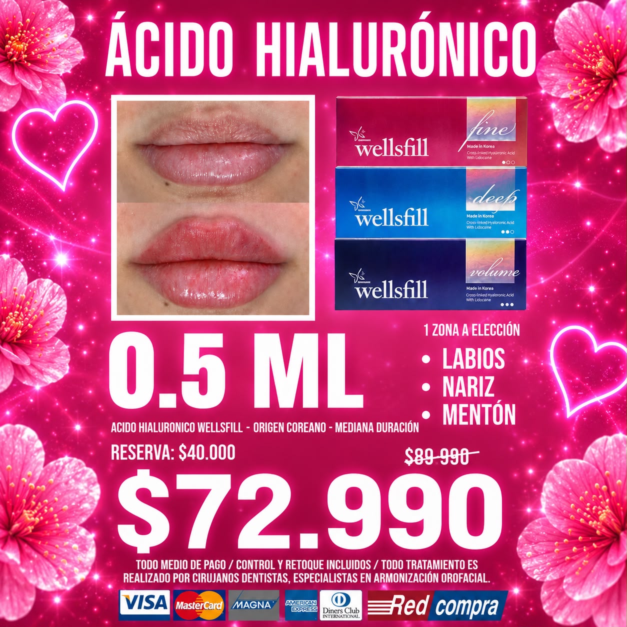 Clínica Estheticskonst Facebook ad: Wellsfill 0.5ml, $72.990
