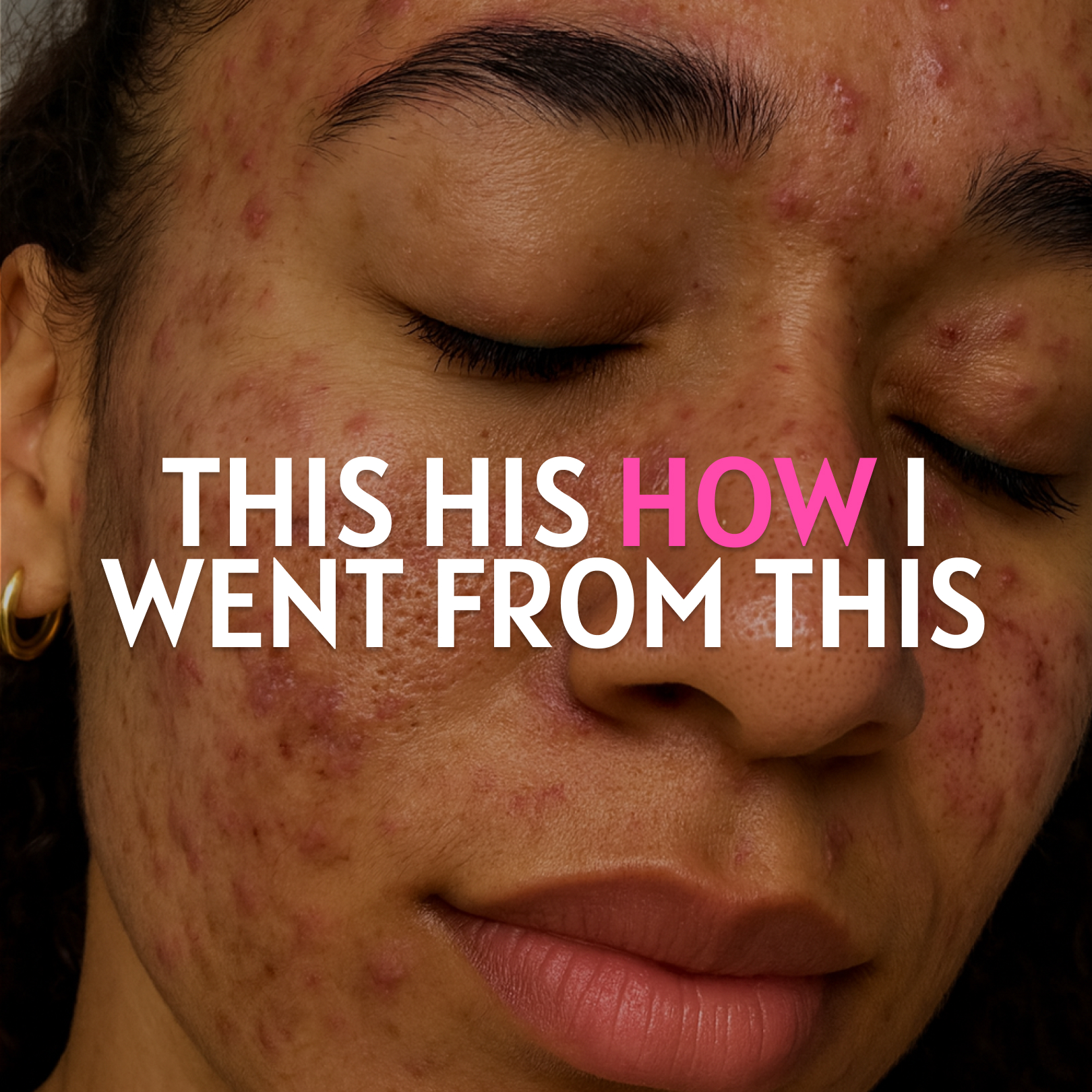 Anne's Skincare Blog Facebook ad