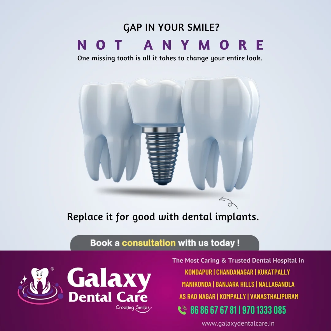 galaxy.dentalcare Facebook ad: Restore your oral health with dental implants.