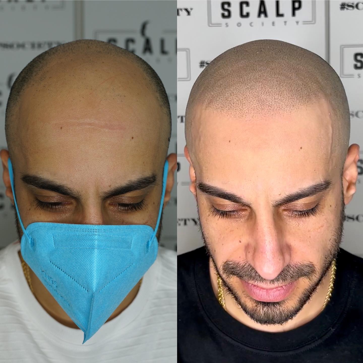Scalp Society - Scalp Micropigmentation Clinic Facebook ad
