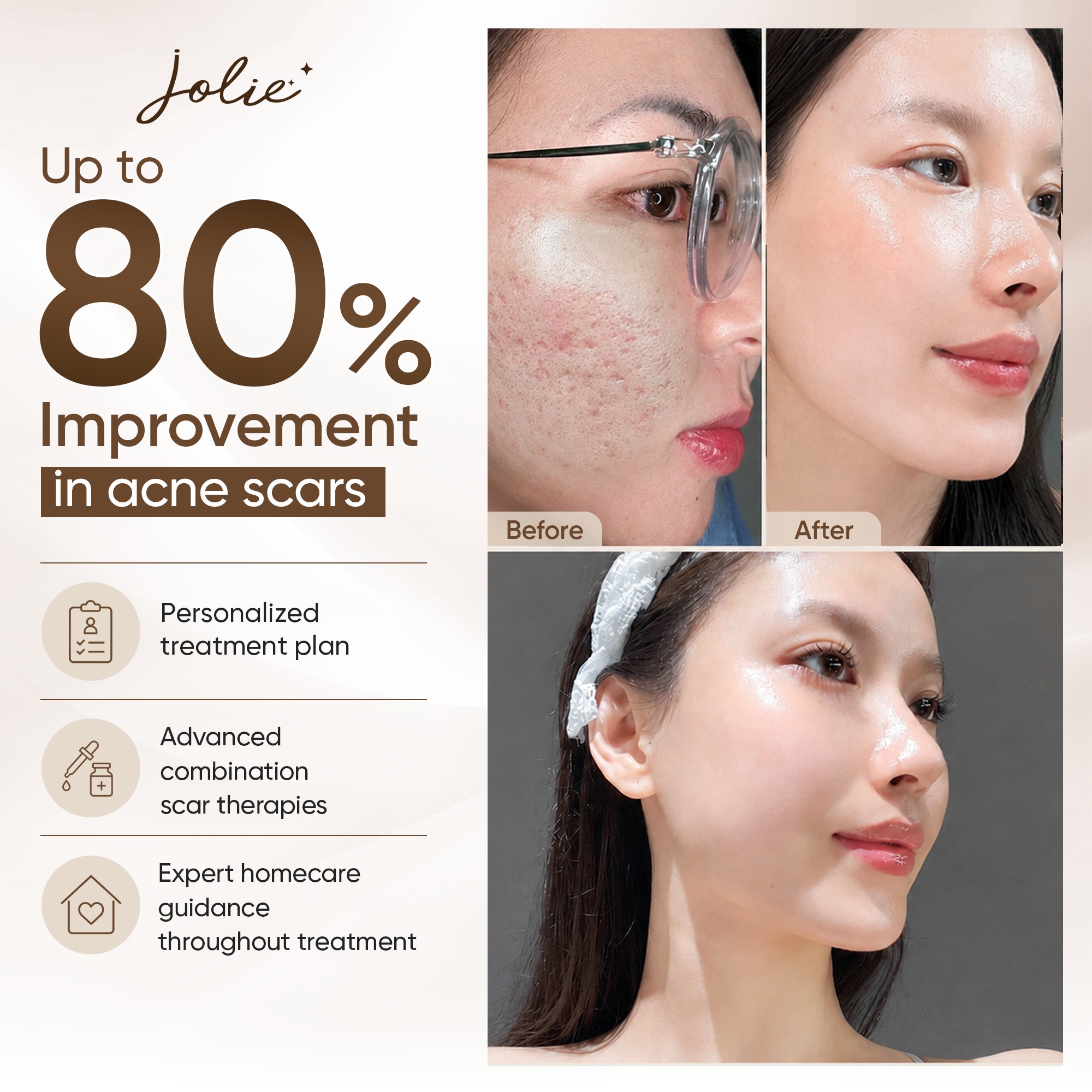 Jolie Clinic Facebook ad