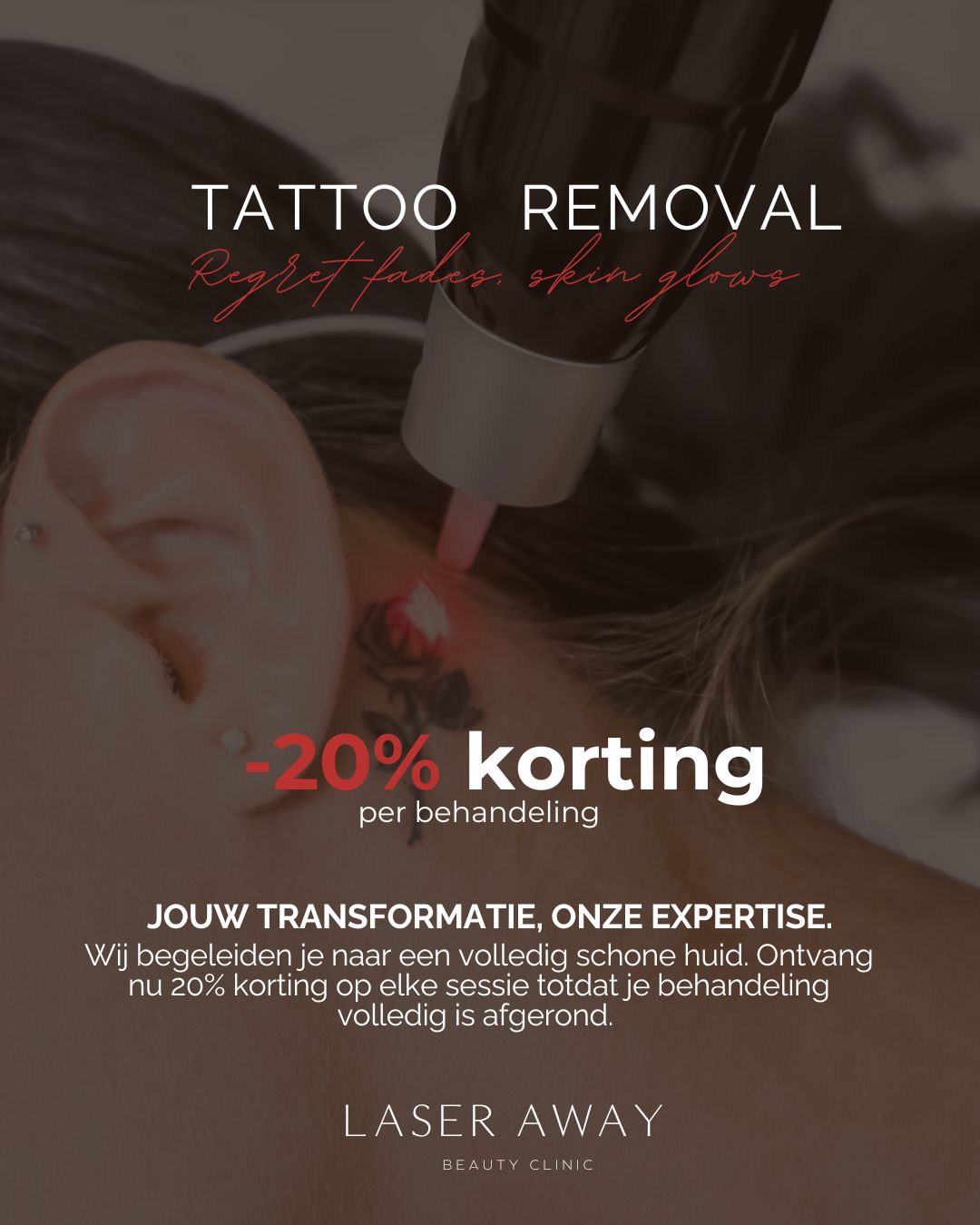 Laser-Away Beauty Clinics Facebook ad: PICOLASER IN ACTIE - ANTWERPEN