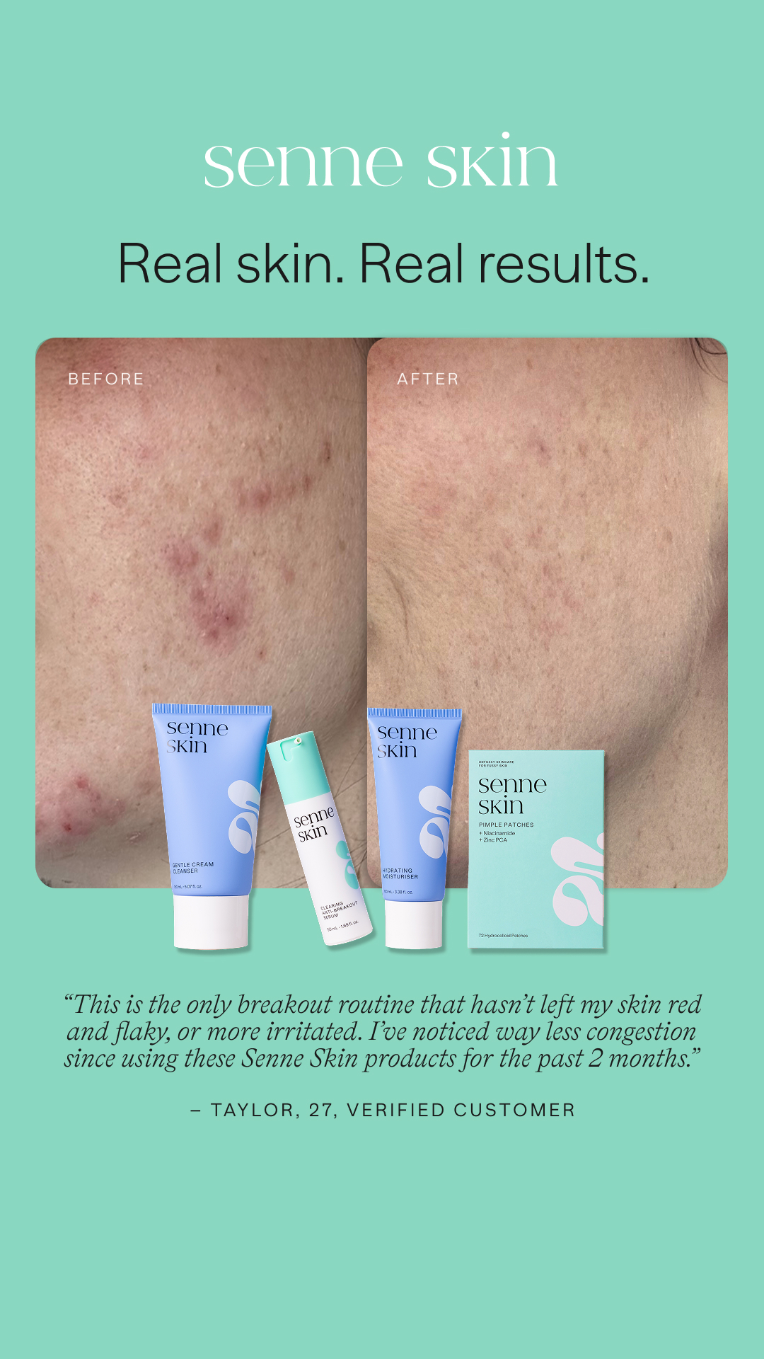 Senne Skin Facebook ad from Feb 2, 2026