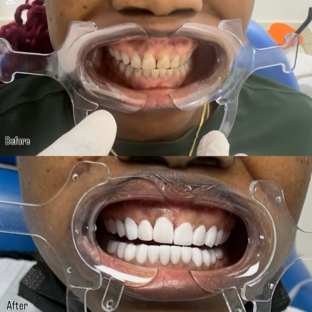 Prime Smile Dental Clinic Facebook ad: Chat on Messenger