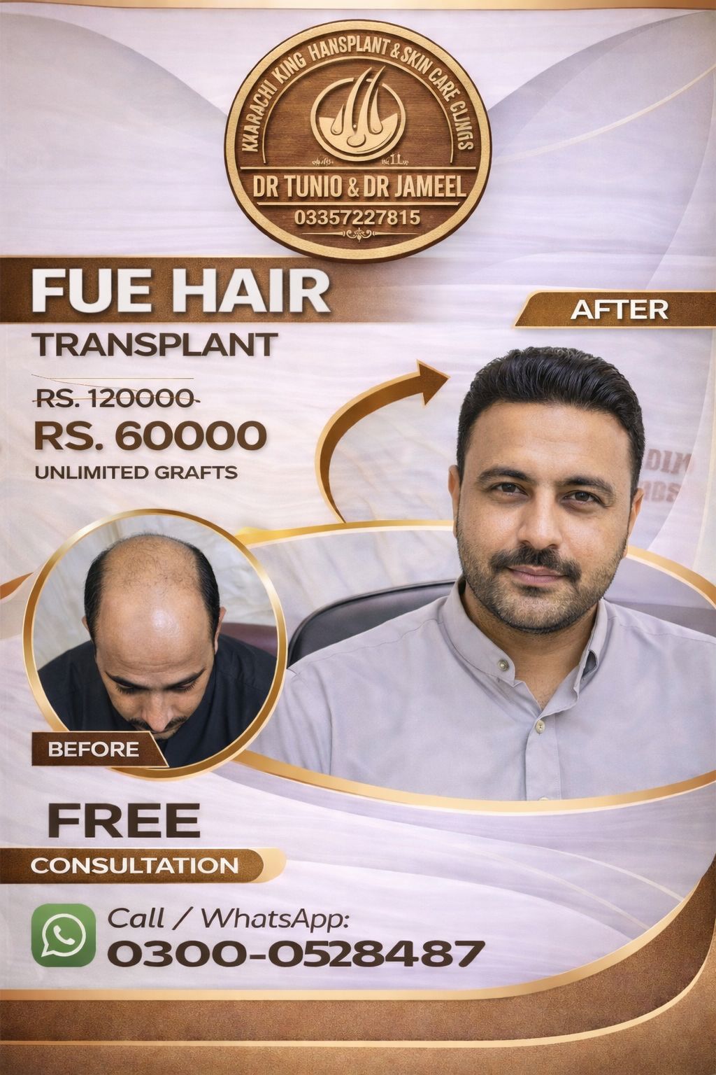 Karachi king skin care & hair transplant Facebook ad