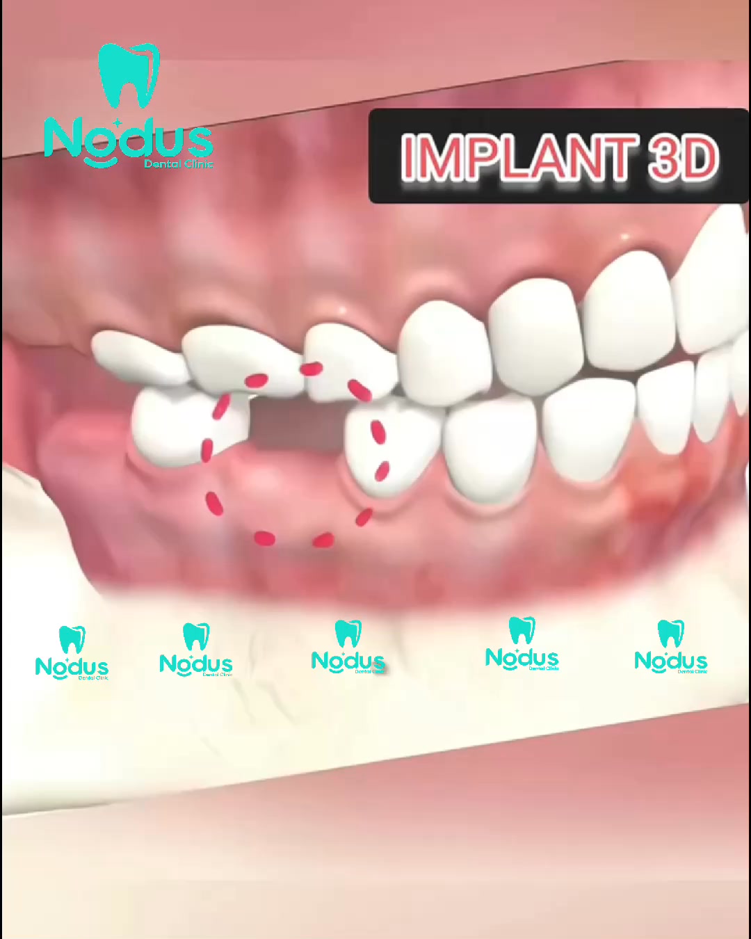 Nodus Dental Clinic Inc Facebook ad: Free consultation >>