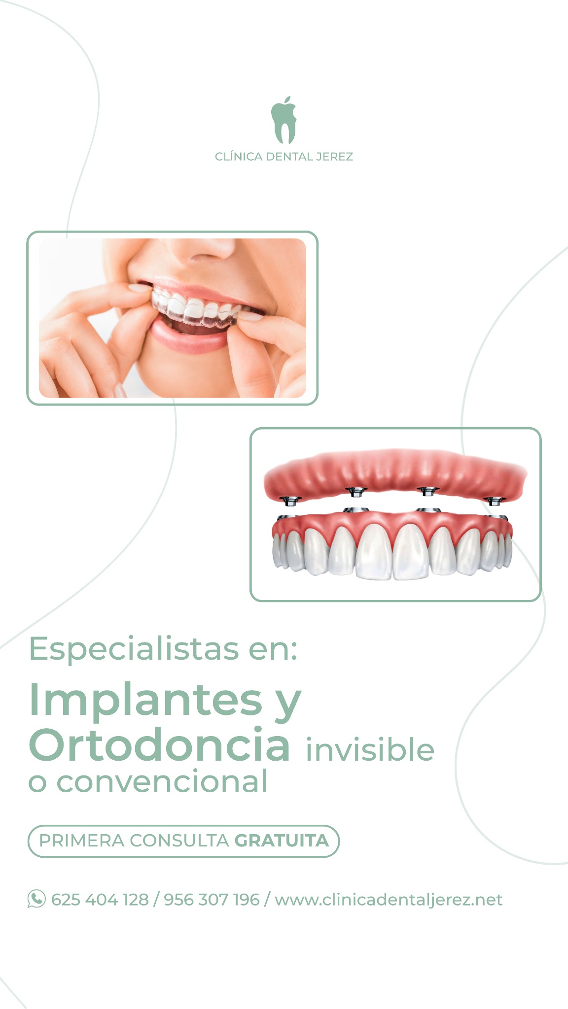 Clínica Dental Jerez Facebook ad