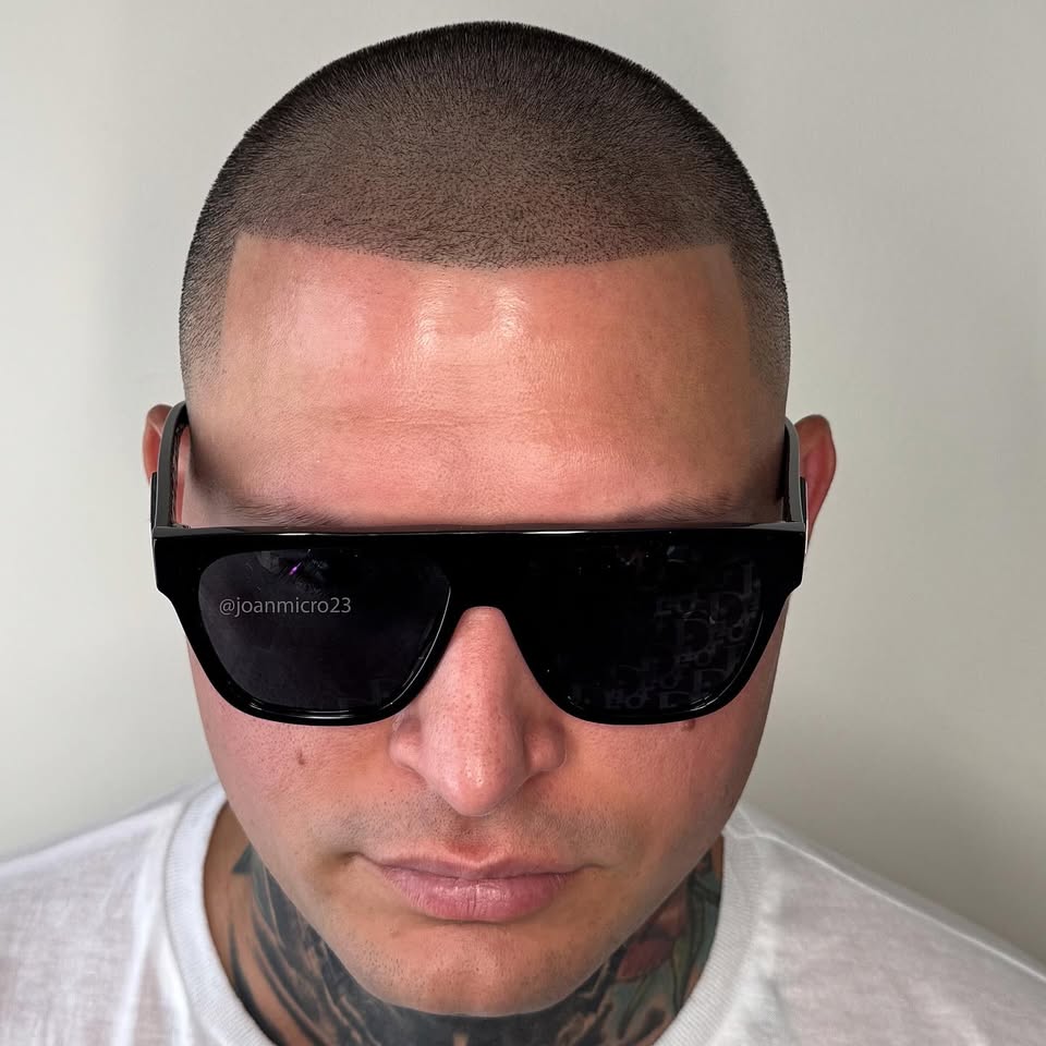Joanmicro23 Facebook ad: •Restore your hairline today with SMP!