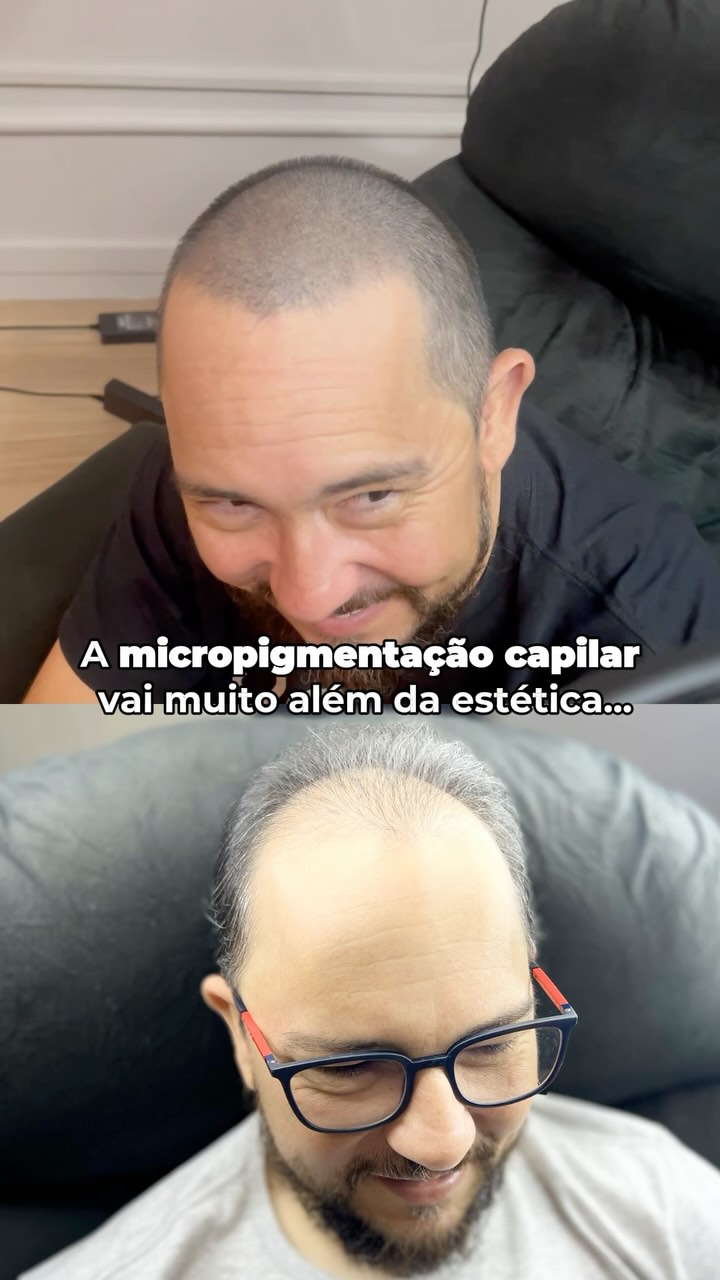 Kaioalvescapilar Facebook ad: A autoestima de um homem é significativamente influenciada…
