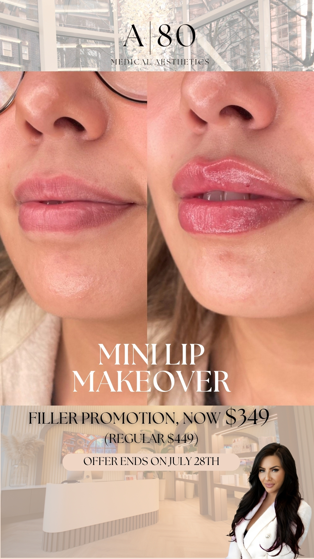 Aurora 80 Medical Aesthetics Facebook ad