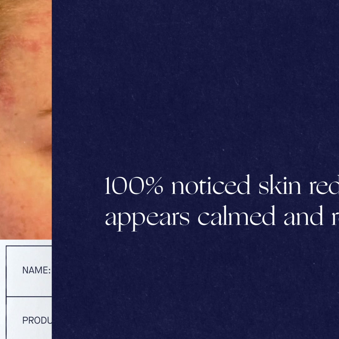 Augustinus Bader Facebook ad: Multi award-winning moisturizer