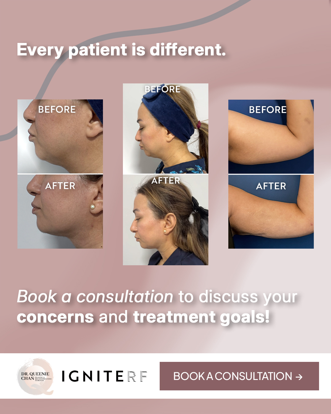 Eclipse Plastic and Aesthetic Surgery Facebook ad