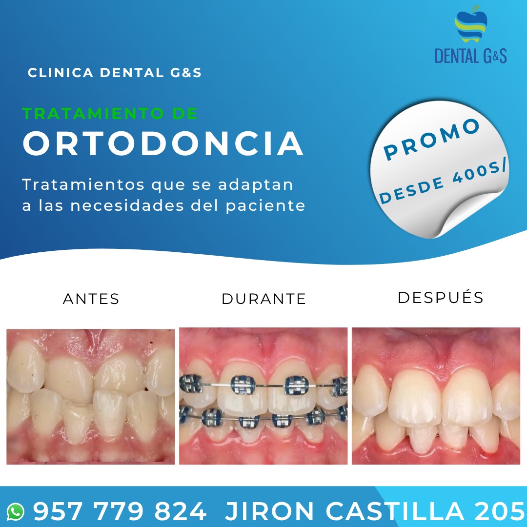 Dental G & S Barranca Facebook ad: ¿Dientes chuecos? ¡No esperes más!