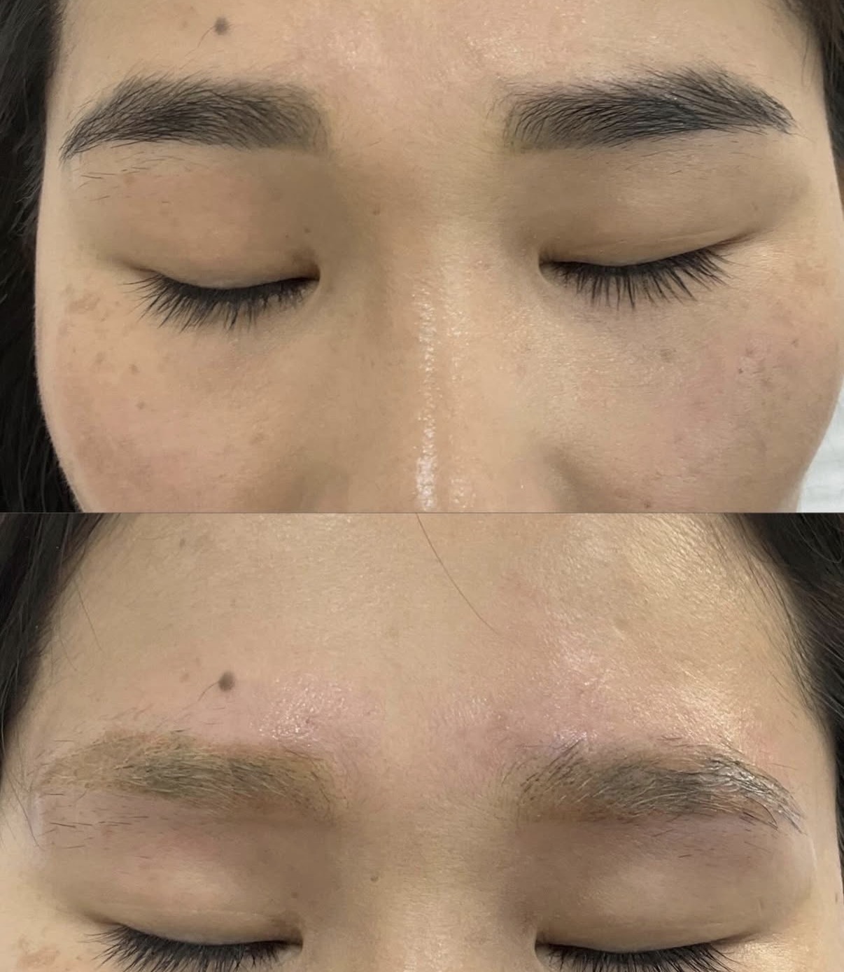 Coastal Skin Clinic - Tattoo Removal Facebook ad: Effective Eyebrow Tattoo removal.
