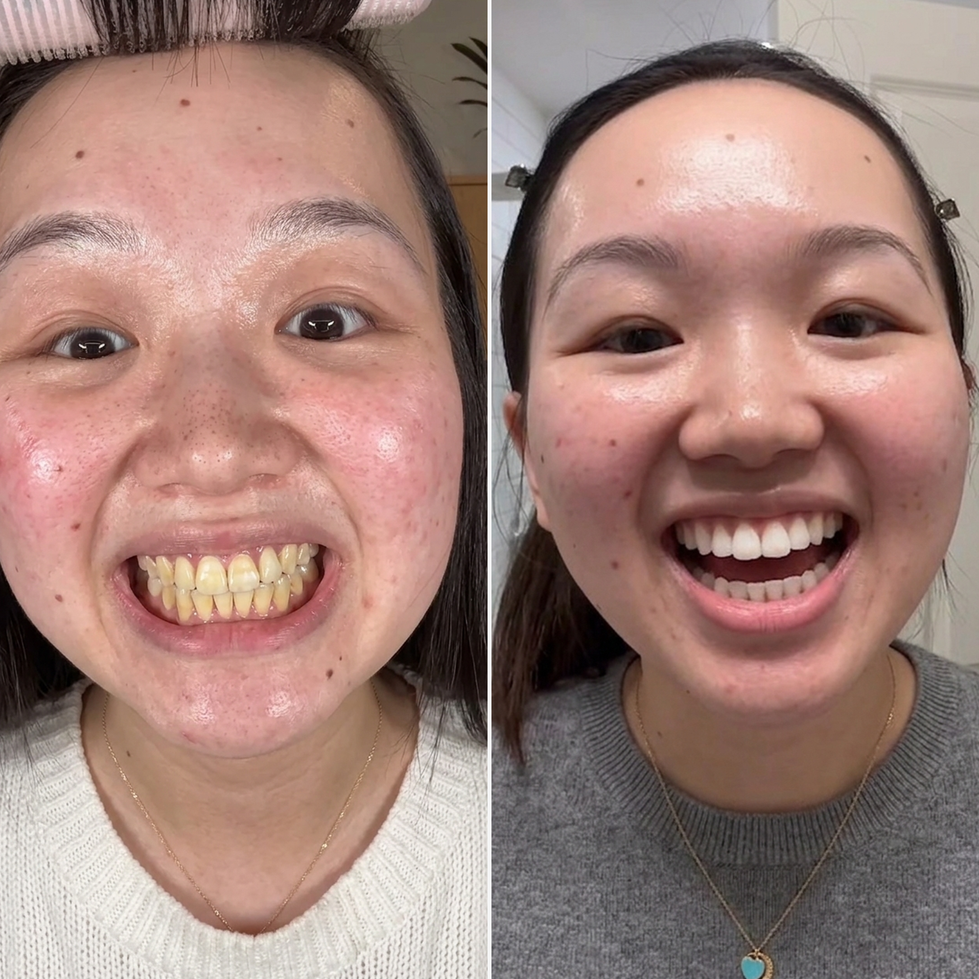Modern Wellness Journal Facebook ad: Whiten Teeth Without Damage in 7 Days