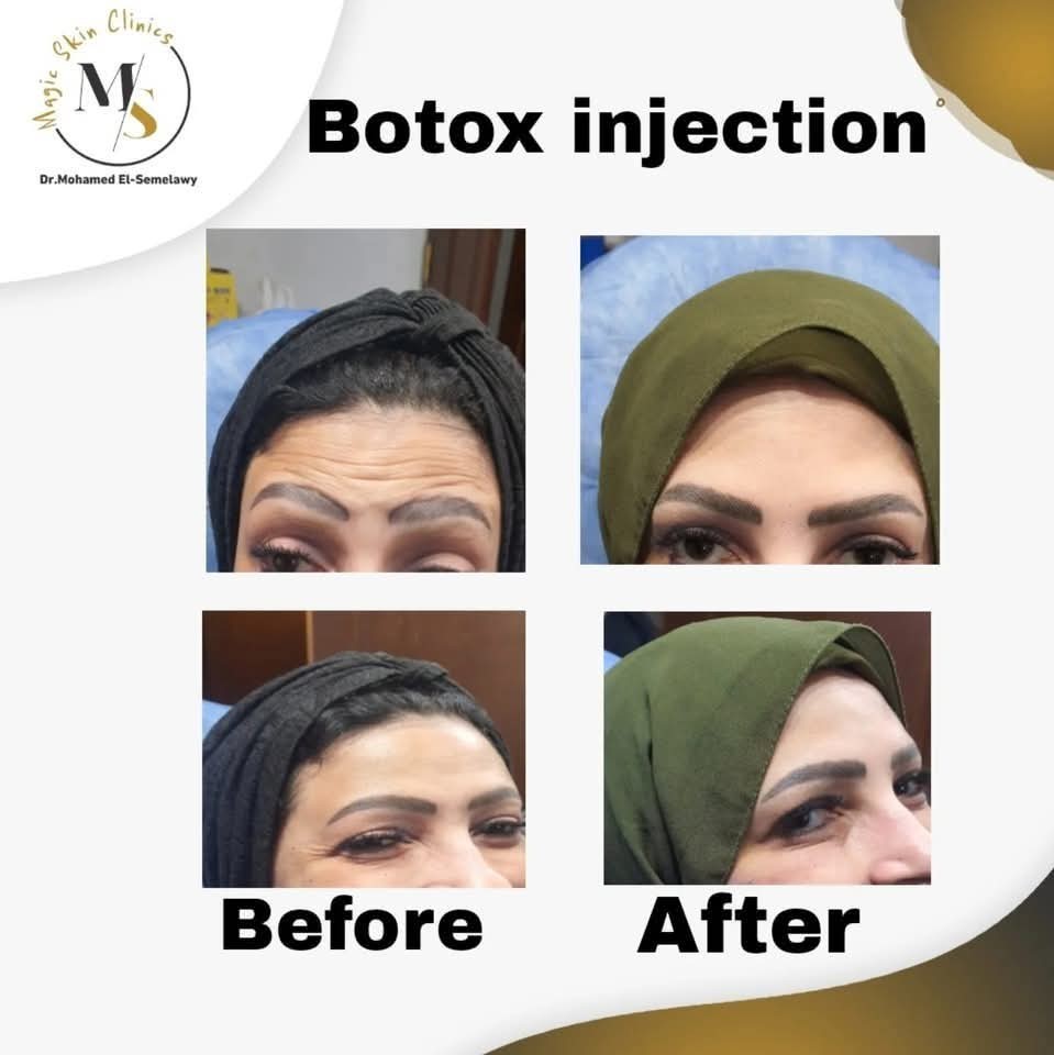 Magic skin clinics Facebook ad