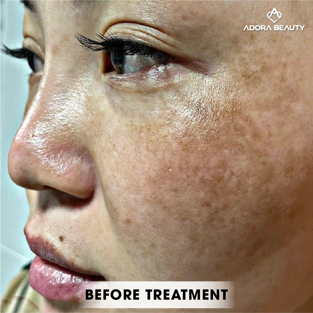 ADORA Beauty Hub - no.1 Center in Manila Facebook ad