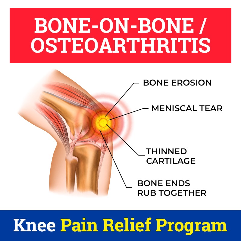 Canyon Ridge Integrative Health Facebook ad: Ultra Successful Knee Pain Treatment Now Covered by…