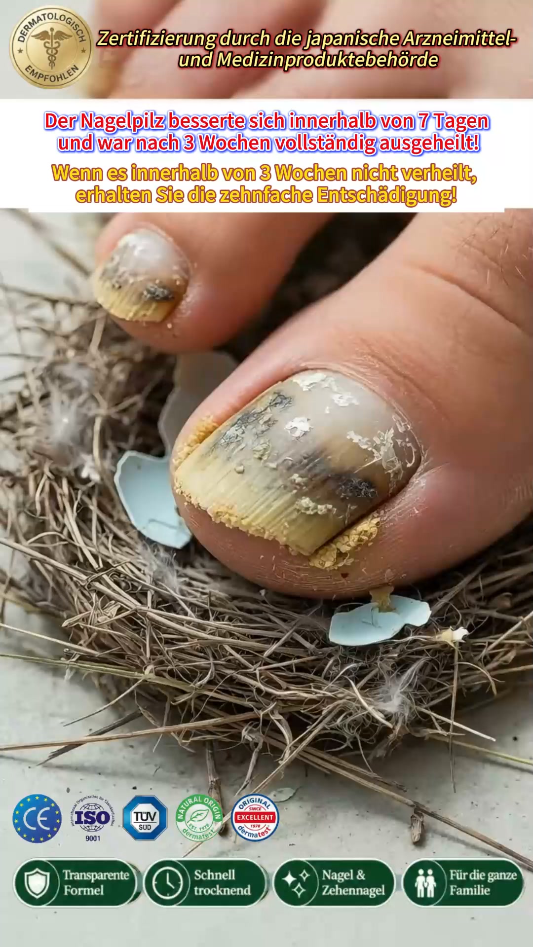 Bizzflowhub3 Facebook ad: Gelbe, dicke oder brüchige Nägel?