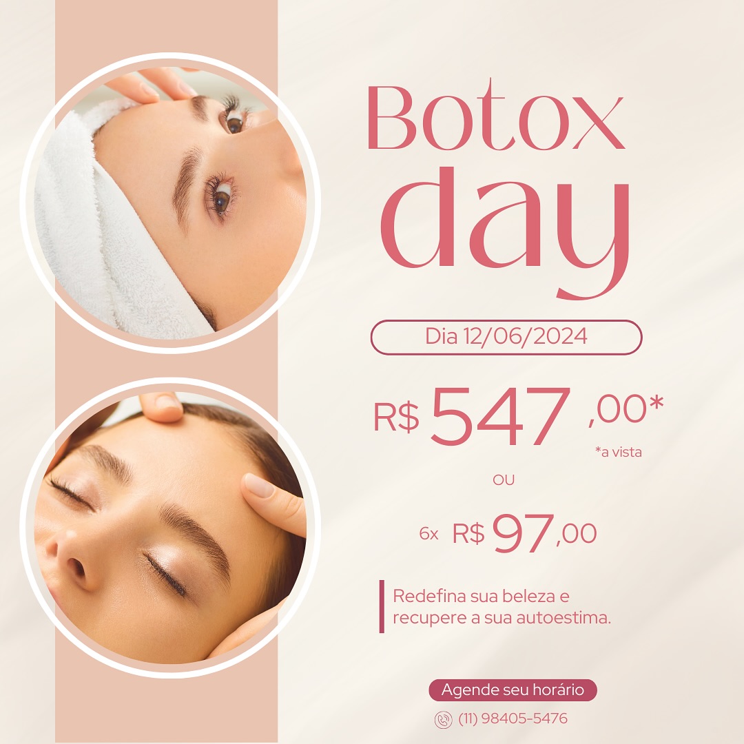 Studio_viver melhor Facebook ad: Promoção Imperdível de Botox!