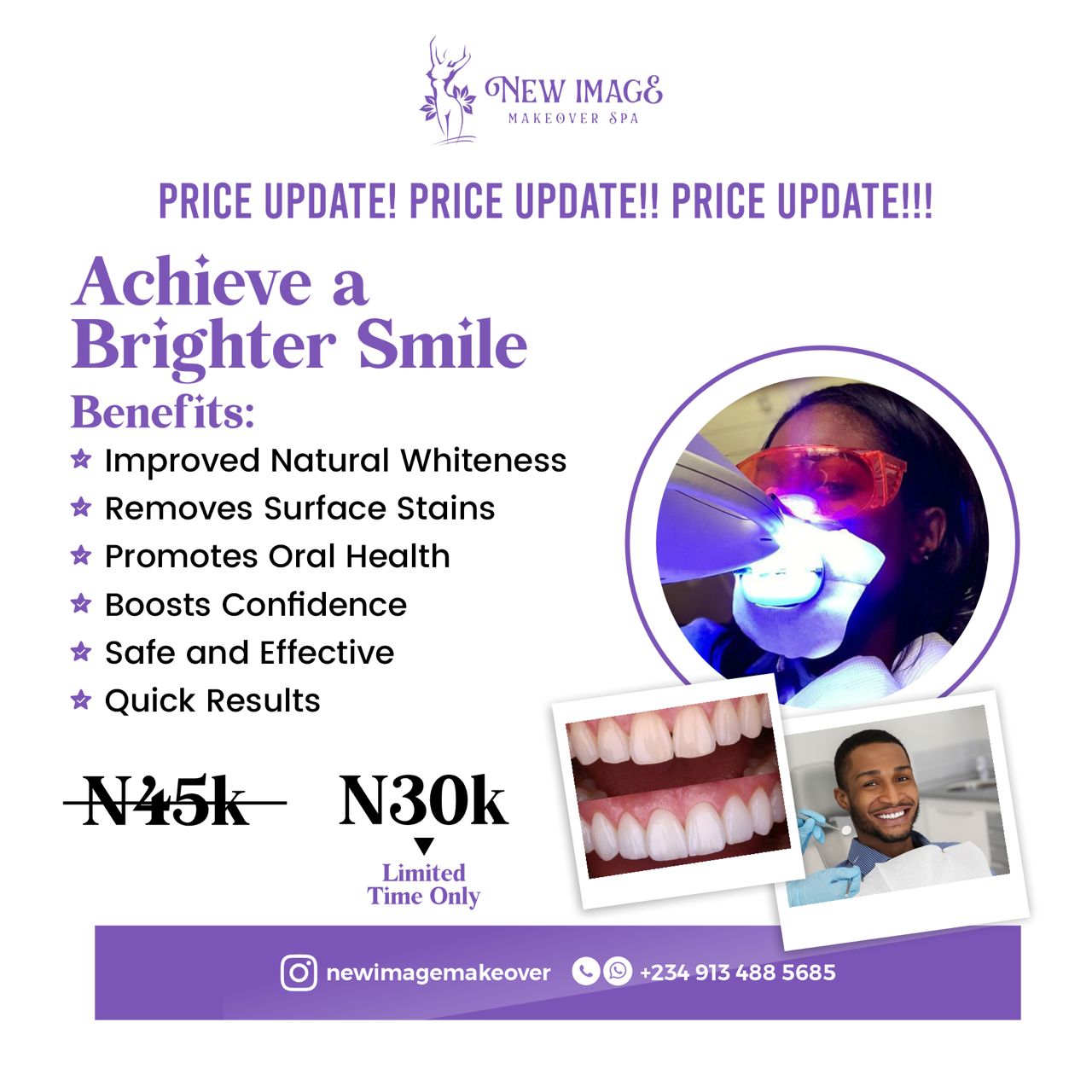 New Image Makeover Spa Facebook ad: The most obvious benefit of teeth whitening is…