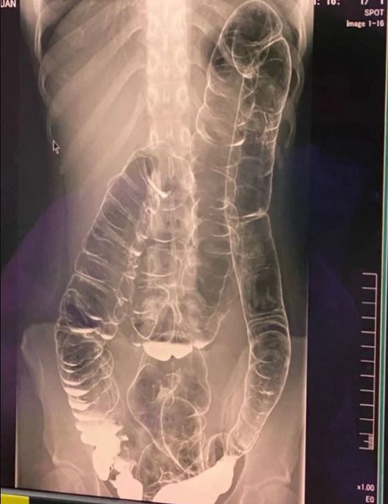 Rachel Bennet Facebook ad: Here's what actually happens when you tell your doctor you…