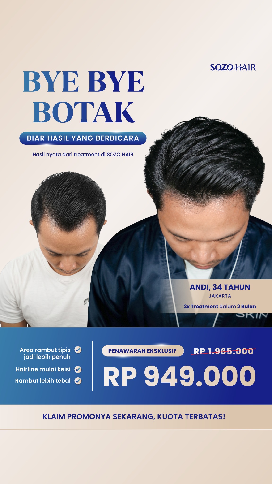 Sozo Skin Clinic Facebook ad