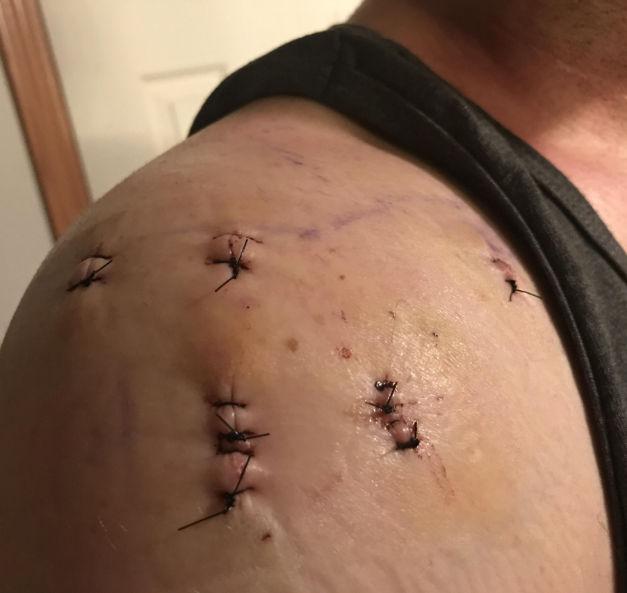 Jackson Miller Facebook ad: $25K SAVED ON SURGERY