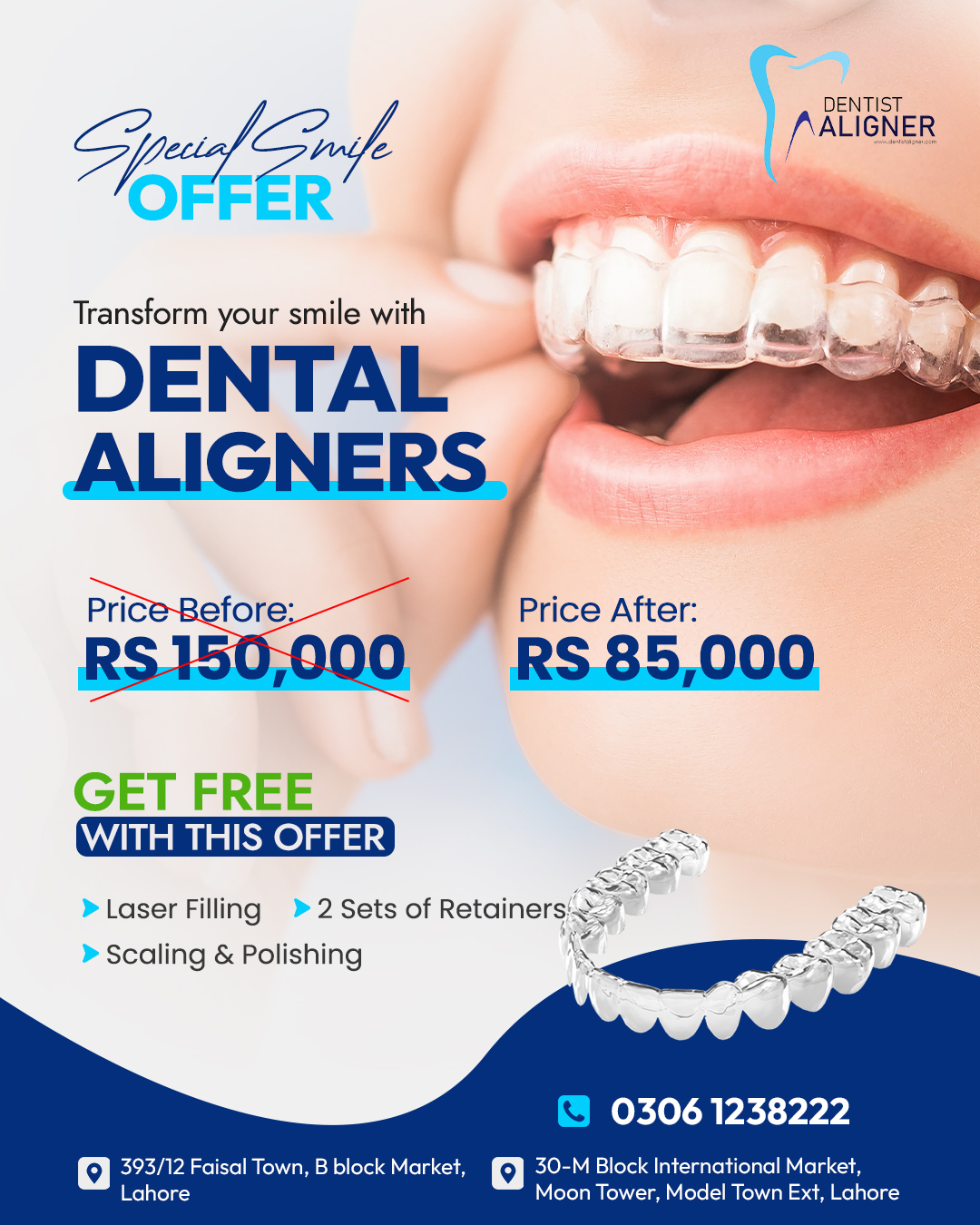 Dentist Aligner Facebook ad